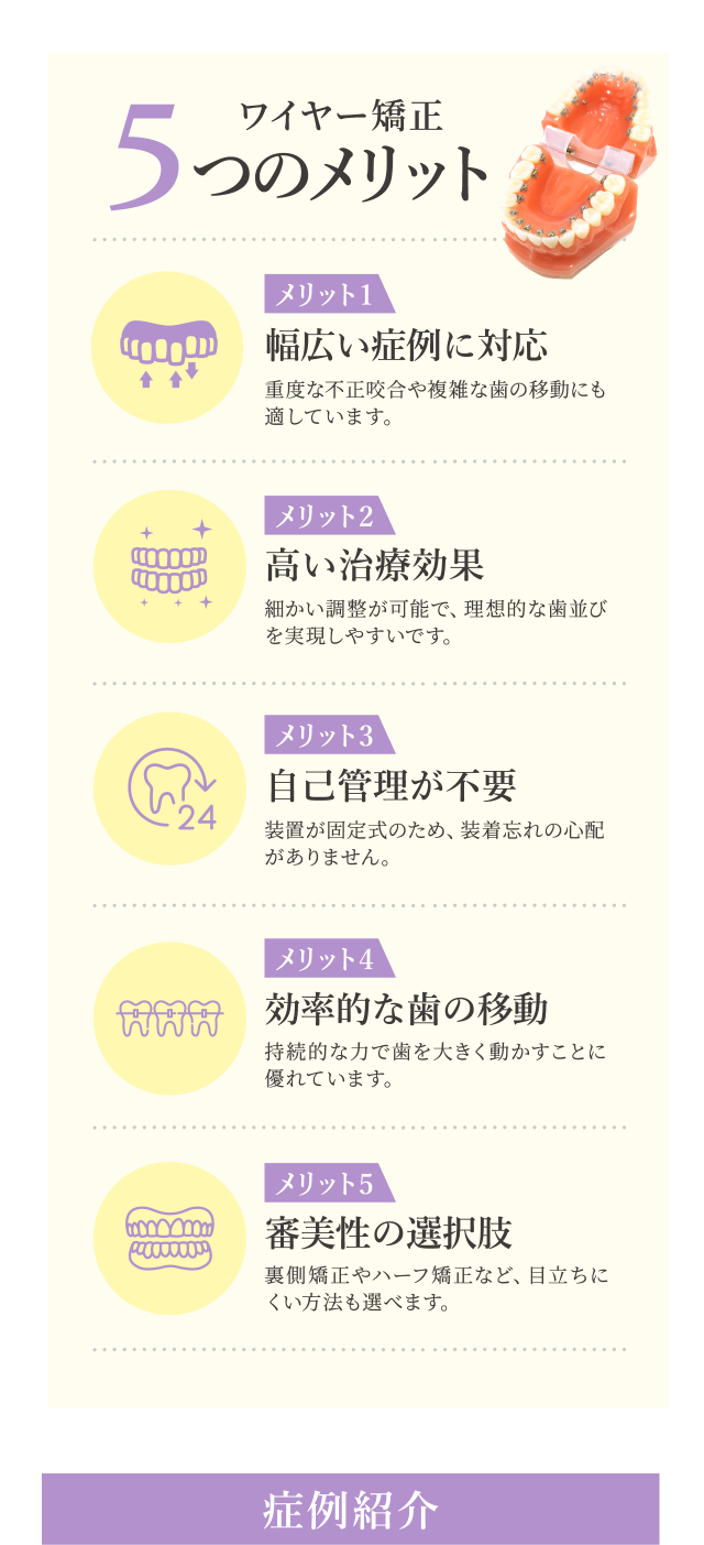 ワイヤー矯正の５つのメリット