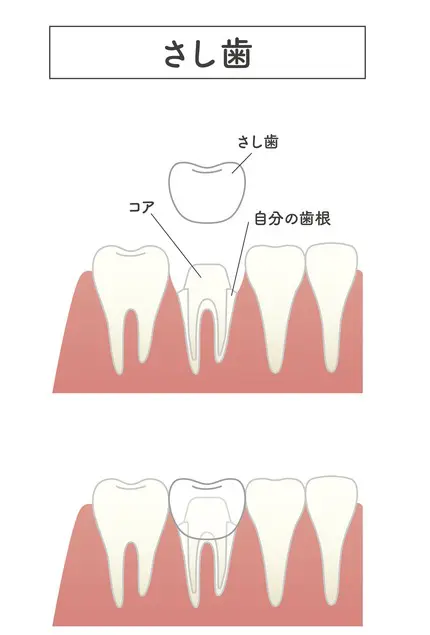 難波　矯正歯科　カウンセリング