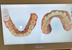 難波　矯正　シミュレーション