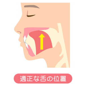 舌癖　正しい舌　位置