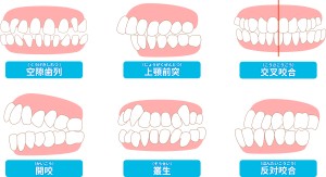 難波　歯科矯正　歯並び