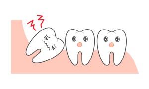 難波　矯正歯科　歯列矯正　歯並び
