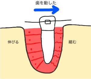 難波　歯列矯正　歯槽骨