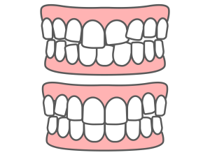 難波　矯正歯科　歯並び