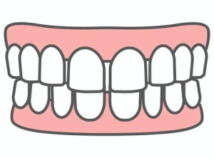 難波矯正歯科　歯列矯正　すきっ歯