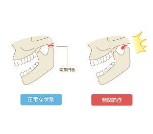 難波　矯正歯科　カウンセリング