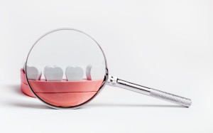 歯の模型と虫眼鏡の画像