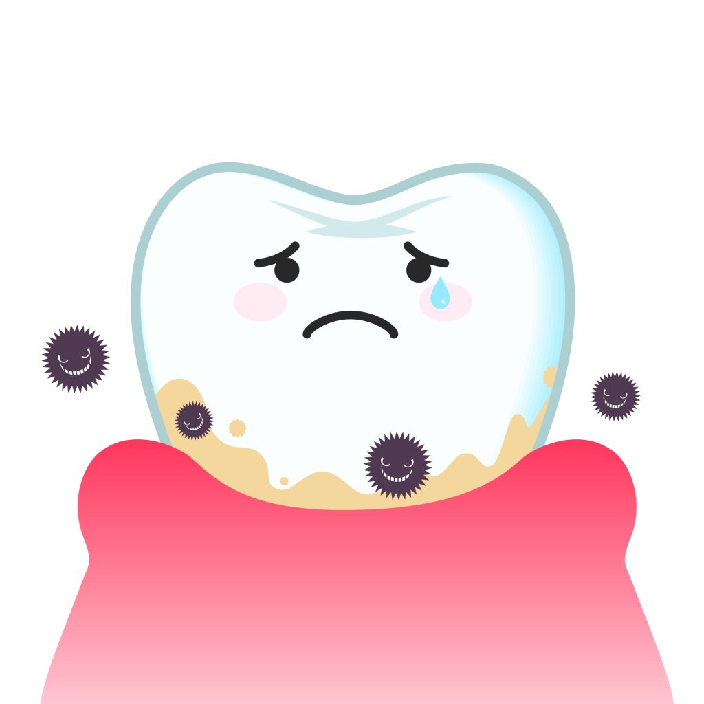 歯周病（歯の汚れ）のイメージイラスト
