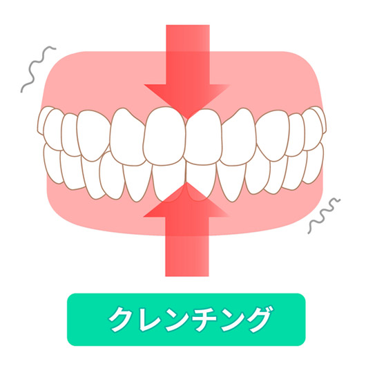 歯ぎしり（クレンチング）のイラスト
