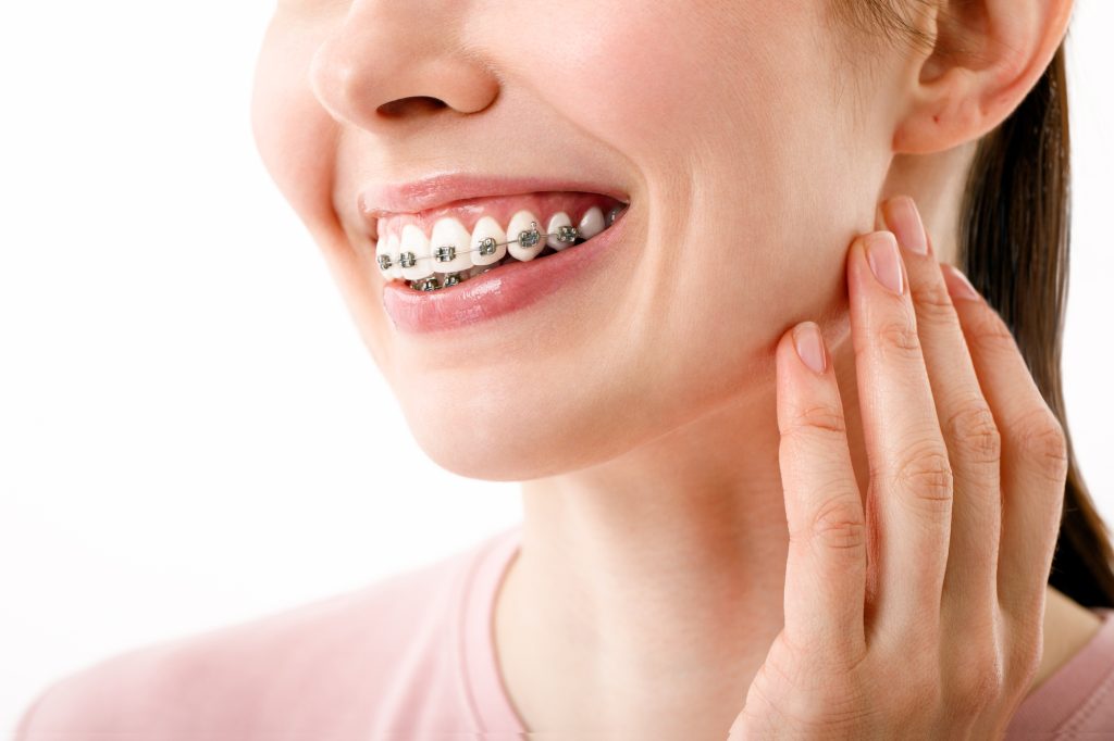 歯列矯正中の大人の女性のイメージ