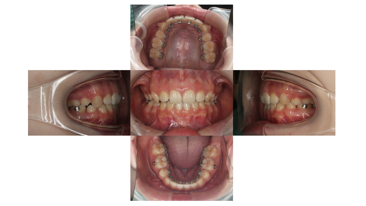 1年6か月経過時