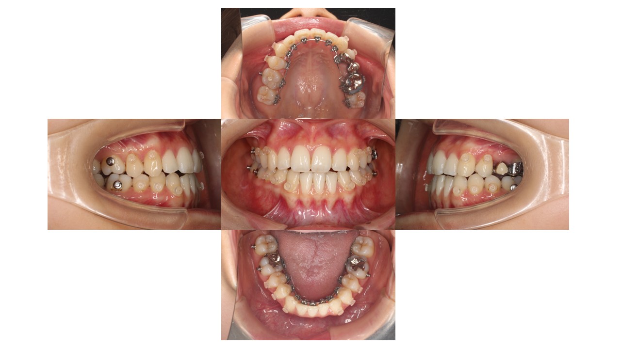 1年7か月経過時