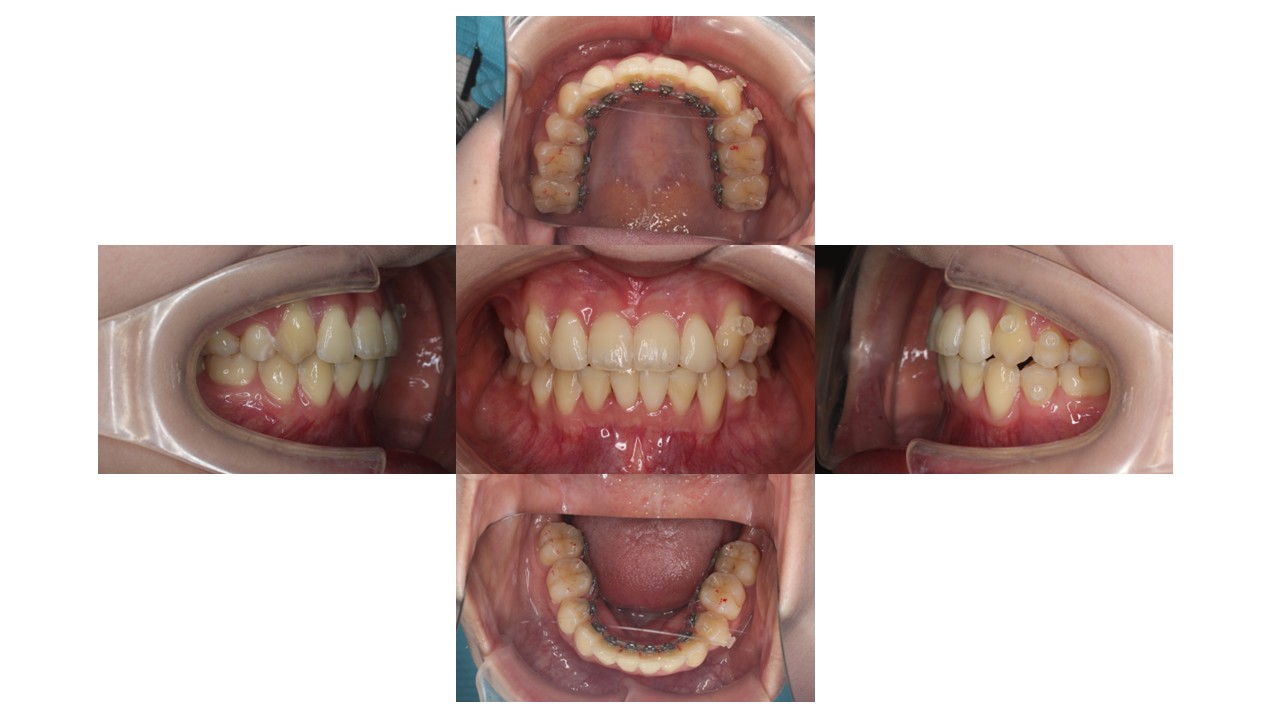 1年6か月経過時