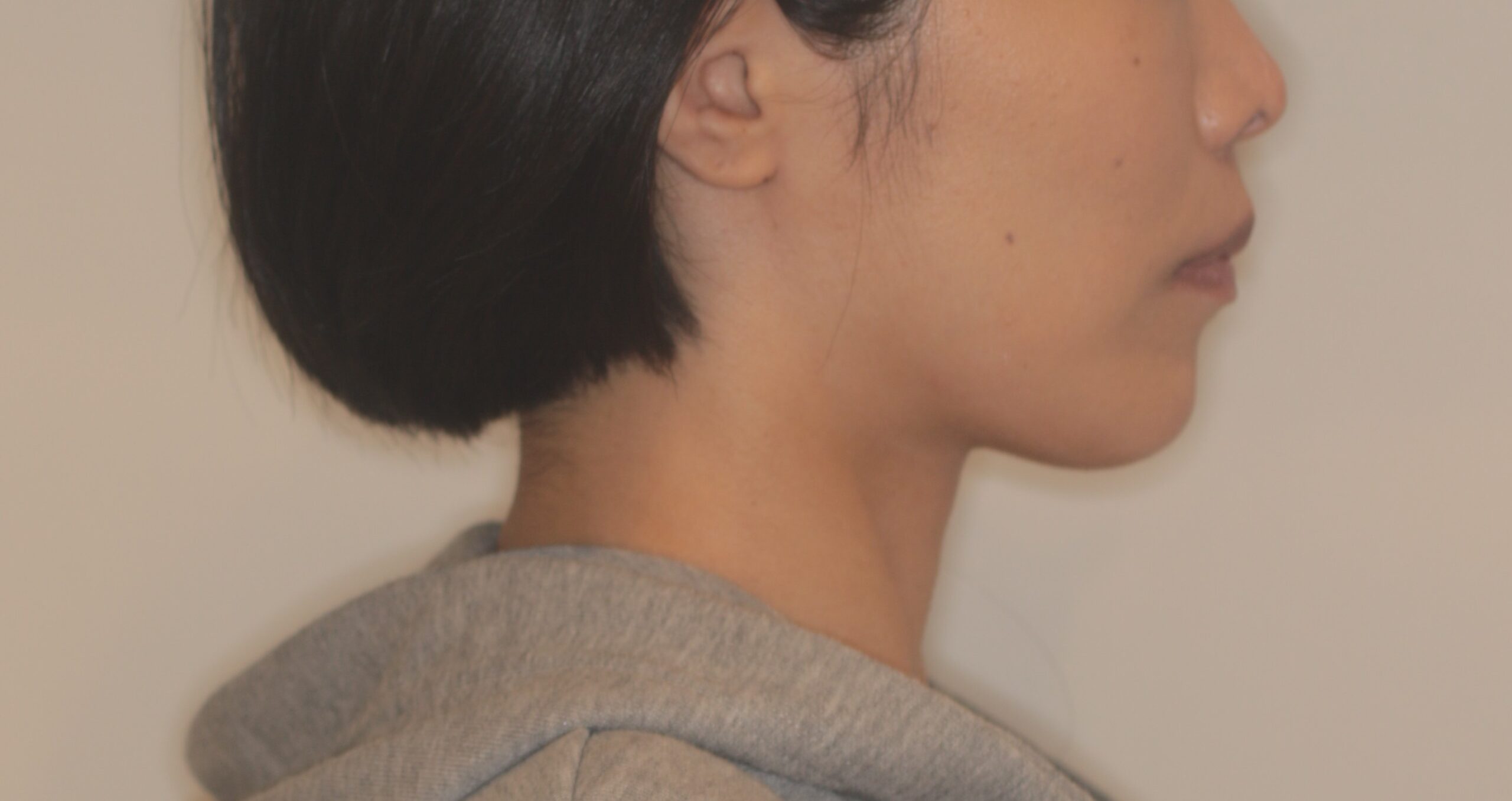 矯正　難波　現在FP