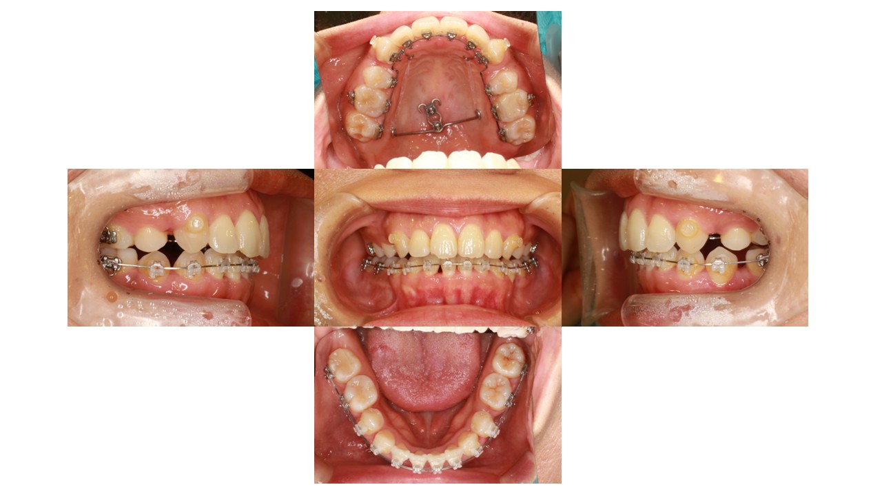 1年6か月経過時