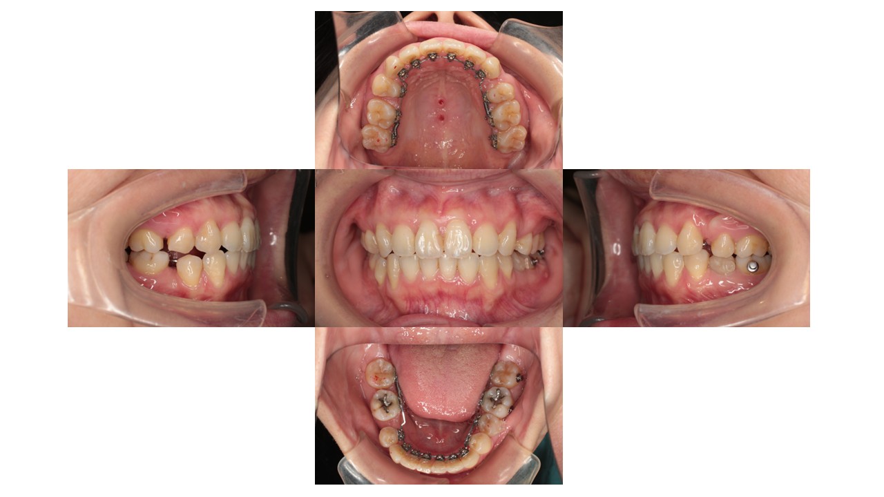 1年7か月経過時