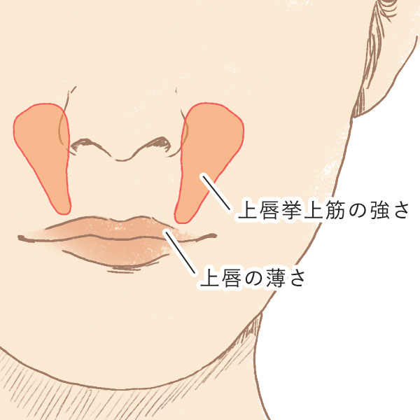 上唇挙上筋の強さ・唇の薄さも原因のひとつ