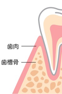 歯槽骨　矯正　難波