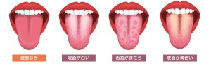 難波　歯列矯正　舌苔