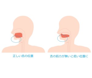 滑舌　矯正　難波