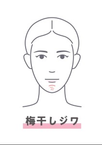 難波　歯列矯正　梅干し　シワ