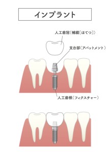 難波　矯正歯科　カウンセリング