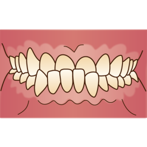 難波矯正歯科　歯科矯正　歯列矯正