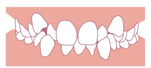 歯科矯正　難波矯正歯科