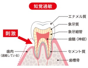 難波矯正歯科　歯科矯正