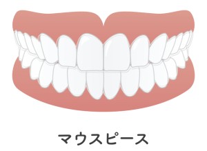 難波　歯列矯正　金属アレルギー