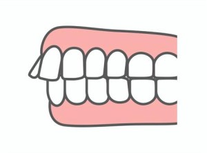 難波　矯正歯科　歯並び