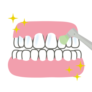 大阪矯正歯科　難波矯正歯科　矯正中のクリーニング